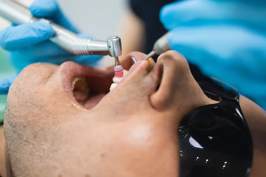 dentist doing teeth cleaning procedure for male pa 2026 03 10 04 49 37 utc