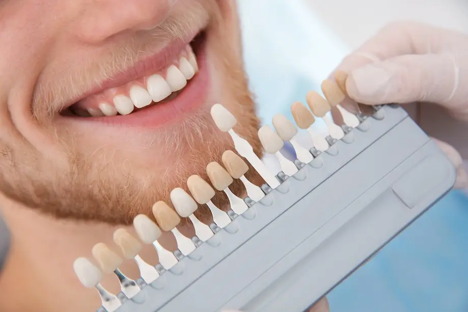 dentist selecting patient s teeth color with palet 2026 03 08 23 02 28 utc
