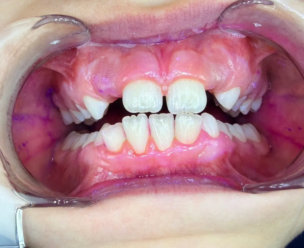 Case 2 After