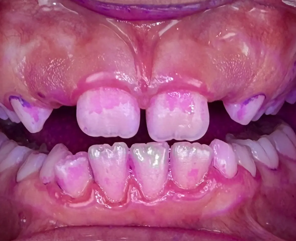 Case 2 Before Case 2 Before